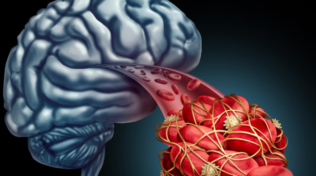 Киви: три плода в день для укрепления иммунитета и защиты сердца