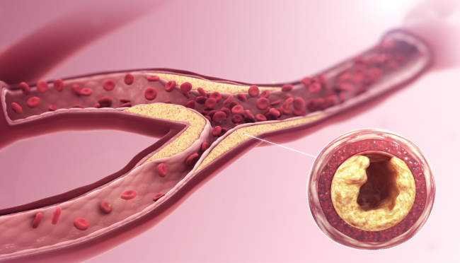 Брусника: как использовать ягоду для соусов и укрепления иммунитета