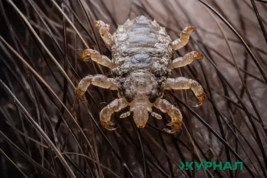 Лобковые вши найдены у нижегородца, несмотря на редкость случаев заболевания